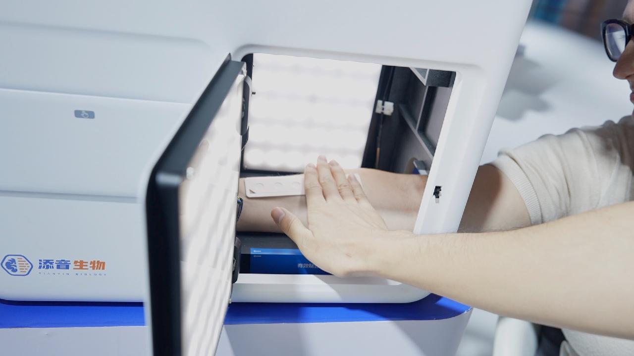 Can a quick skin test tell if you're depressed?
