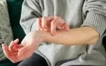 اگر خارش پوستتان ادامه‌دار است، این هشدار را جدی بگیرید