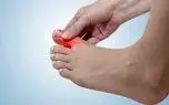 علت ابتلای  انگشتان پا به التهاب مفصلی چیست؟