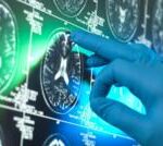 Breakthrough £90,000 Alzheimer's drugs unlikely to benefit patients, report suggests