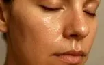 علت چرب شدن پیشانی و بینی؛ معرفی روش‌هایی برای کنترل آن