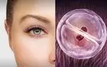 جوان سازی سلول های آسیب دیده چشم با فعال سازی سه ژن