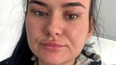 Open wounds and eyes that can't close - women warn about cheap bleph eyelid surgery