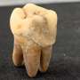 Ancient dental calculus reveals diverse diets of commoners in premodern Osaka, Japan, the 'Kitchen of the Realm'