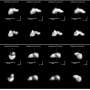 Asteroid Nysa's rare three-lobed structure challenges formation models