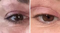 'My eyelids became infected - I was scared to sleep'