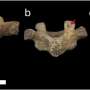 Centuries of child labor left lasting spinal damage in Dutch children, study finds