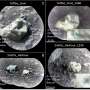 Ruby-forming mineral found by Mars rover hints at violent impacts