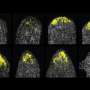 Hydra rebuilds the body by restoring its internal cellular map