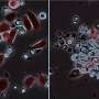 Natural born killers—tracking immune cells as they cluster around cancer