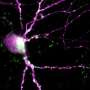 New optogenetic tool inhibits activity in neurons and heart muscle cells