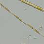 Study provides detailed assessment of shifts in toxin producing phytoplankton abundance