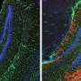 Ubiquitin marks abnormal glycogen for destruction to protect the brain, study finds