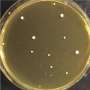 Candida auris copies its entire genome to survive antifungal treatment, research reveals