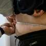 Research into weight-loss drugs tipped for Nobel as award week opens